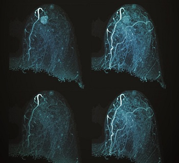 Advances in Breast Imaging; image credit: Douglas et al., doi 10.1117/1.JMI.11.3.034501