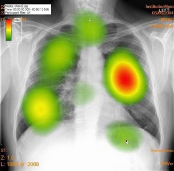 Medical Image Perception and Observer Performance JMI Call for Papers